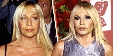 porquoi donnetella versace fait du botox|Donatella Versace blonde.